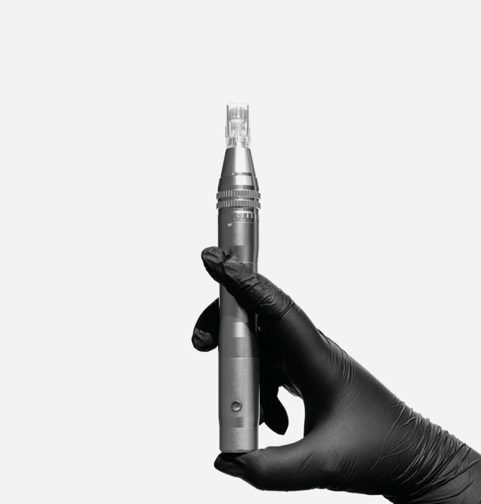 Nanoneedling – ülitõhus naha tekstuuri ja sära parandamine ilma torketeta