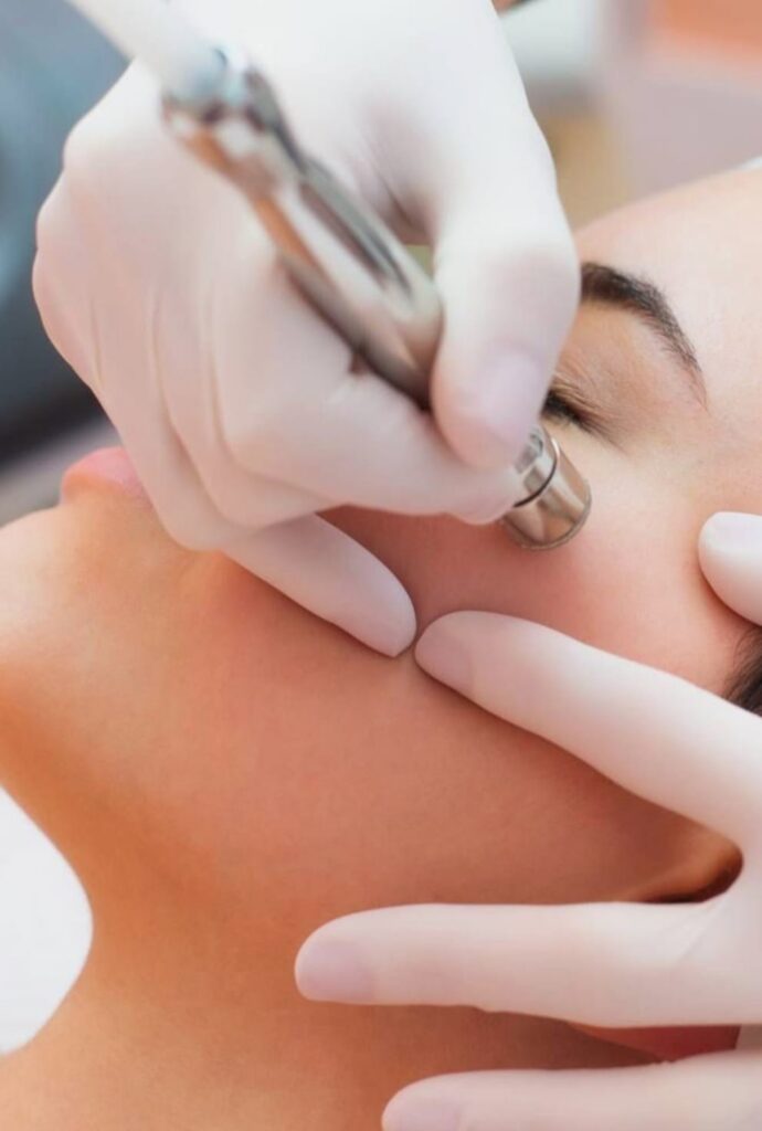 Mikrolihvimine + happekoorimine – topeltuuendus nahale